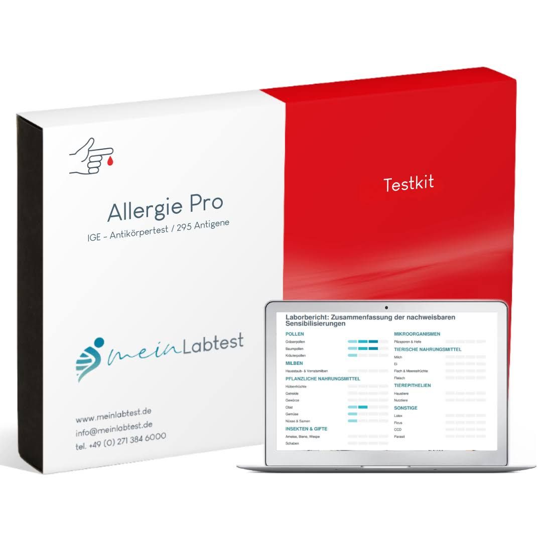 Allergie Pro Testkit und Laptop. Testkit-Box und Laptop mit Testergebnissen. Logo und Produktname sichtbar.