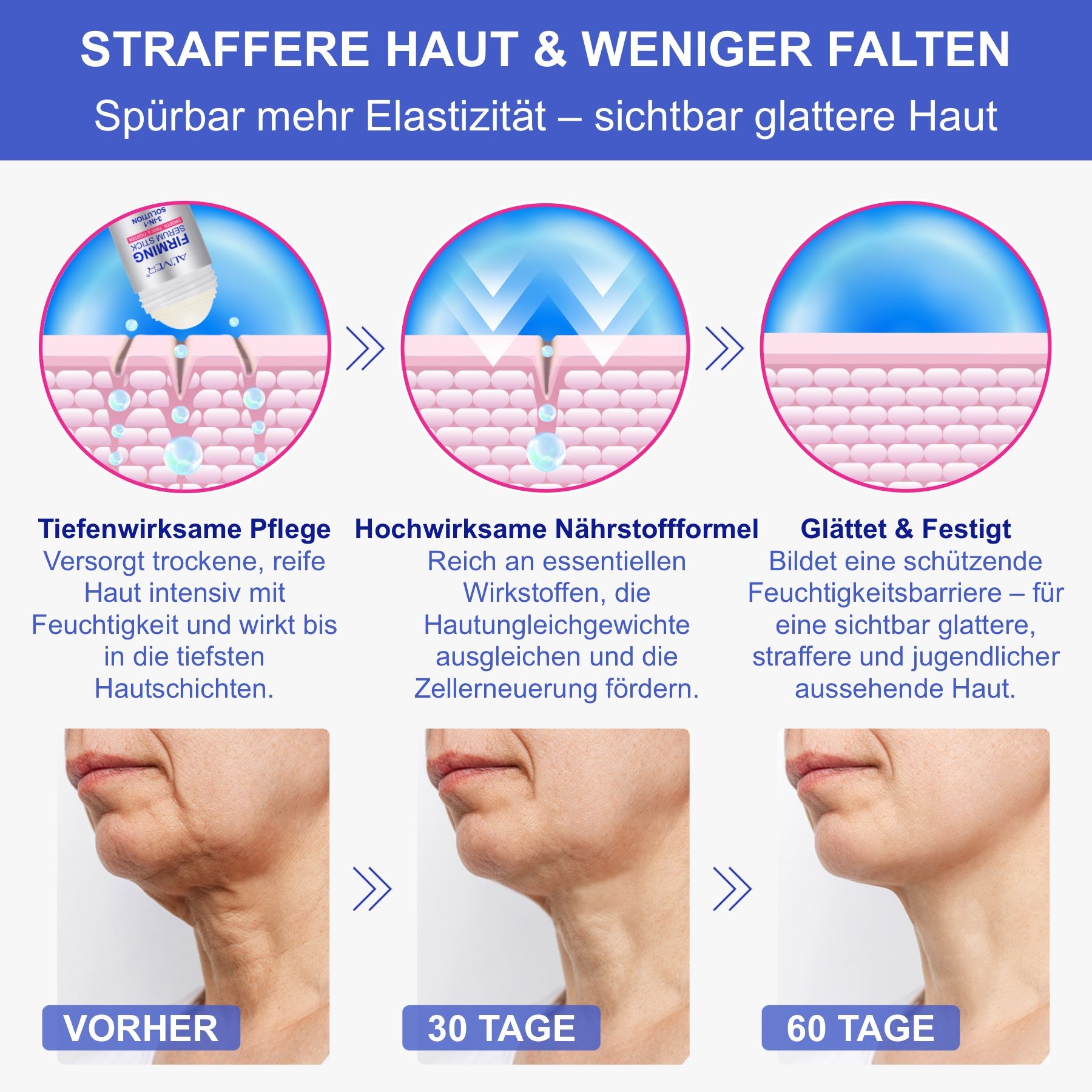 Vorher-Nachher-Bilder. Hautveränderungen nach 30 und 60 Tagen. Straffere Haut, weniger Falten.
