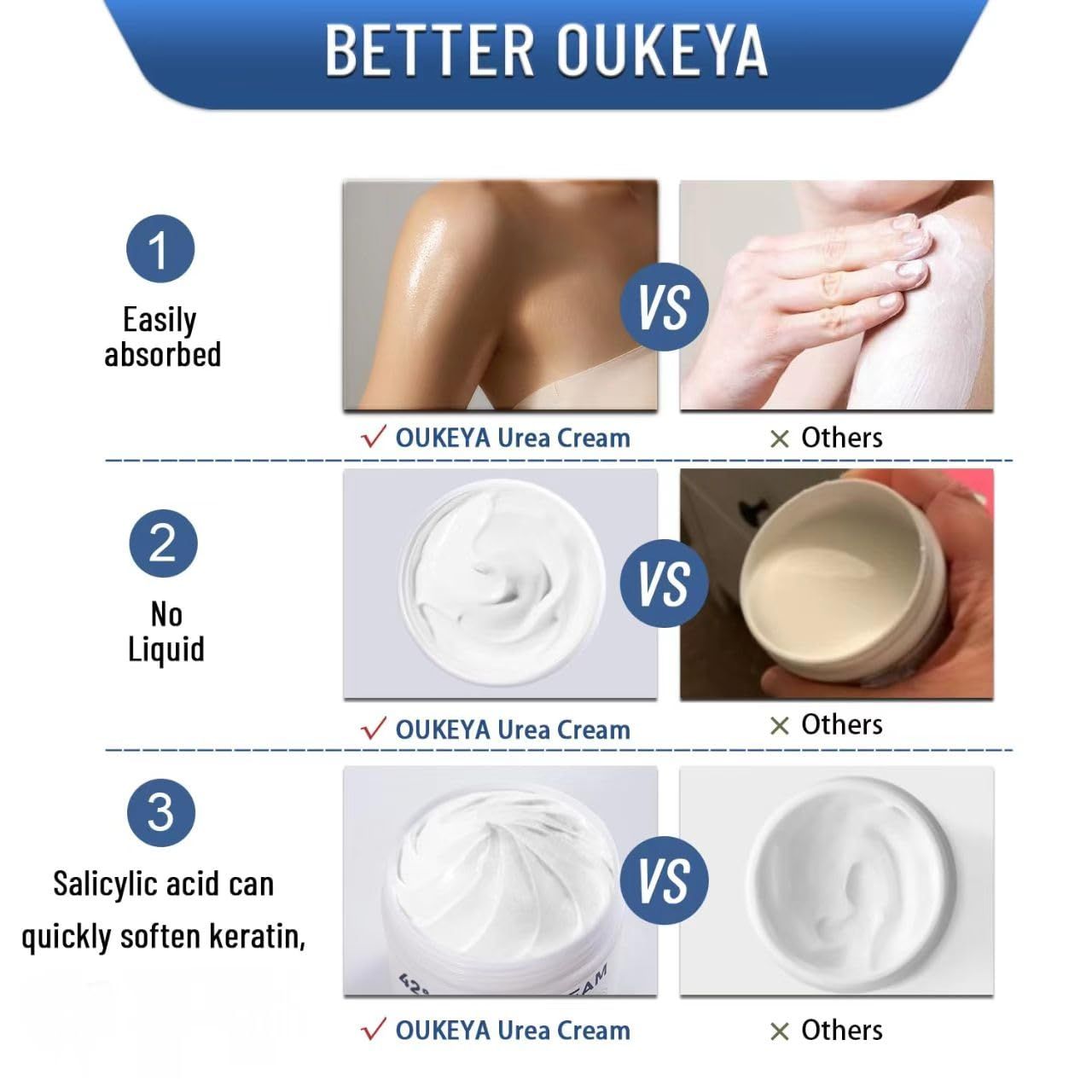 OUKEYA Urea Creme 42% mit 2% Salicylsäure Fusscreme