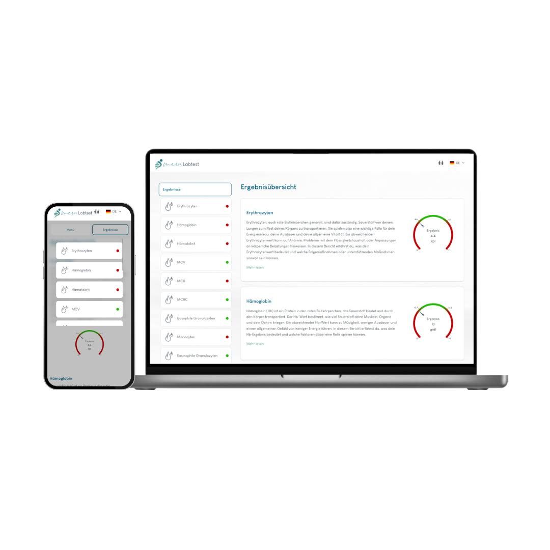 Laptop und Smartphone mit Testergebnissen. Auf dem Laptop "Ergebnisübersicht". Auf dem Smartphone Testergebnisse.