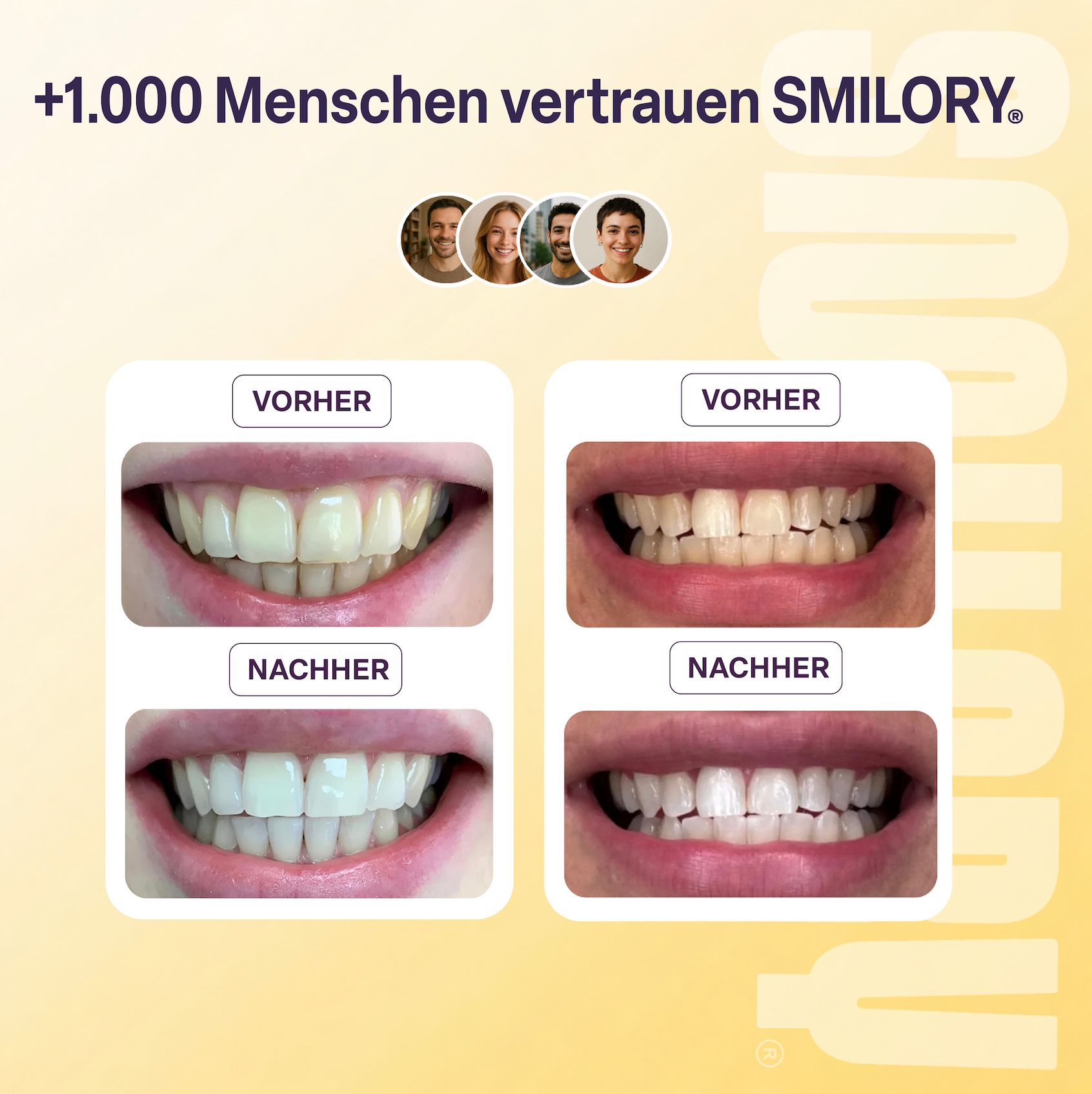 Vorher-Nachher-Vergleich von Zähnen. Vier Paare von Bildern zeigen Aufhellung. Text: +1.000 Menschen vertrauen SMILORY.