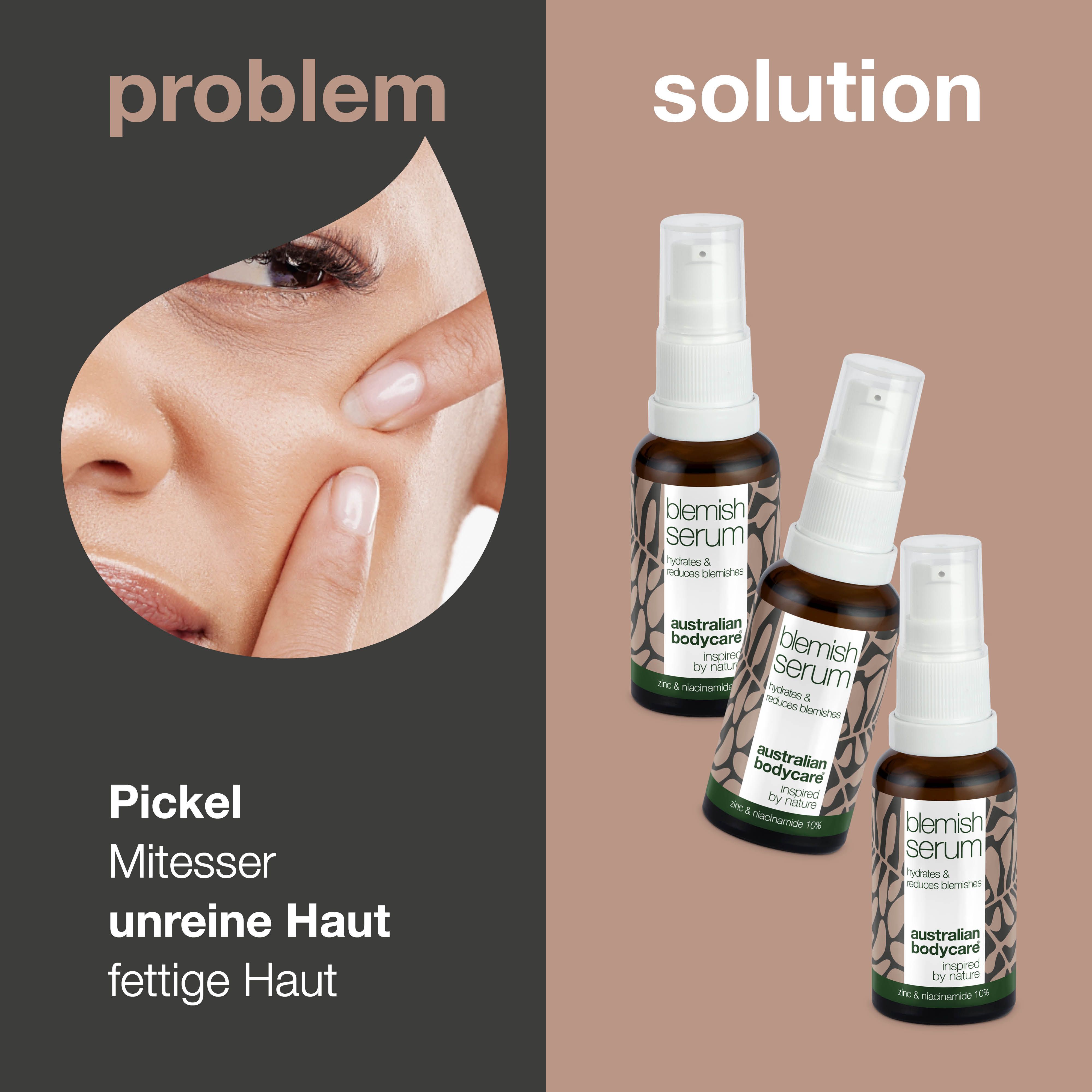 Problem-Lösungs-Darstellung. Gesicht mit Pickeln, daneben drei Serumflaschen. Text: Pickel, unreine Haut.