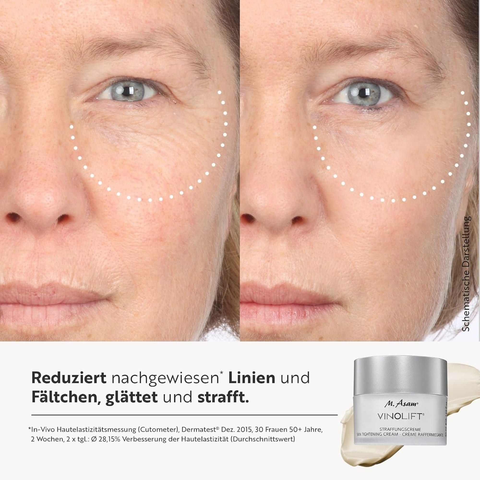 Vorher-Nachher-Vergleich von Gesichtsfalten, die durch M. Asam Vinolift Straffungscreme reduziert wurden.