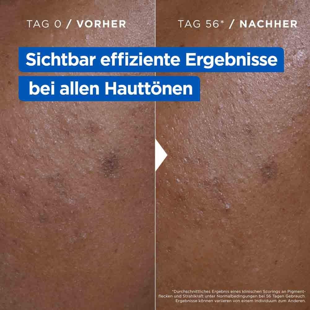 Hautvergleich: Vorher/Nachher. Text: Sichtbar effiziente Ergebnisse bei allen Hauttönen.