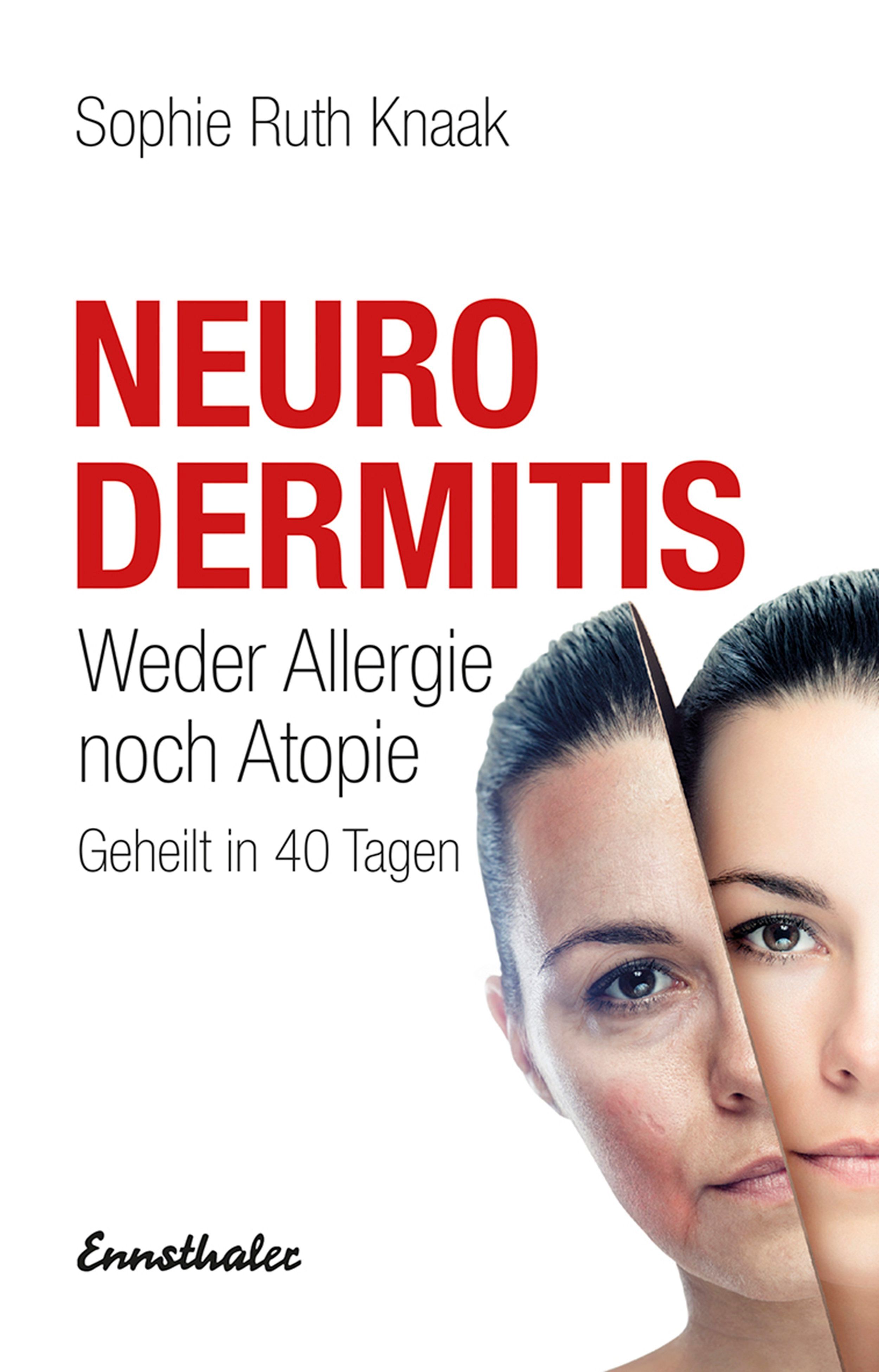 Buchcover mit dem Titel „Neurodermitis“. Autorin: Sophie Ruth Knaak. Gesicht einer Frau mit und ohne Hautausschlag.