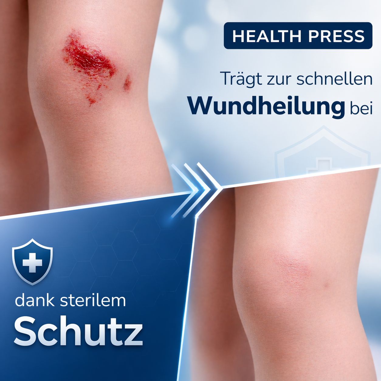 Vorher-Nachher-Darstellung einer Knieverletzung, die mit Health Press Pflastern behandelt wird.