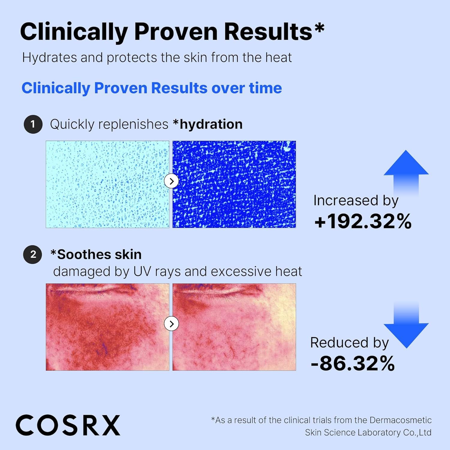 Grafik: Klinisch nachgewiesene Ergebnisse. Hydratation erhöht um +192,32%. Hautberuhigung reduziert um -86,32%. Marke: COSRX.