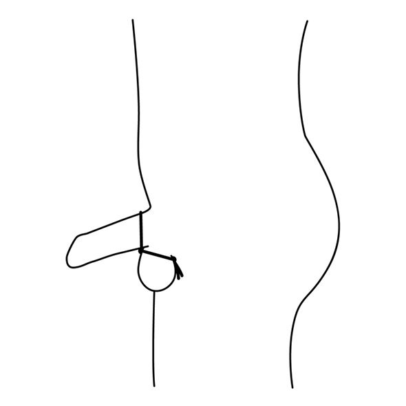Schematische Darstellung eines Penis mit einem Cockring. Der Ring umschließt den Penisansatz.