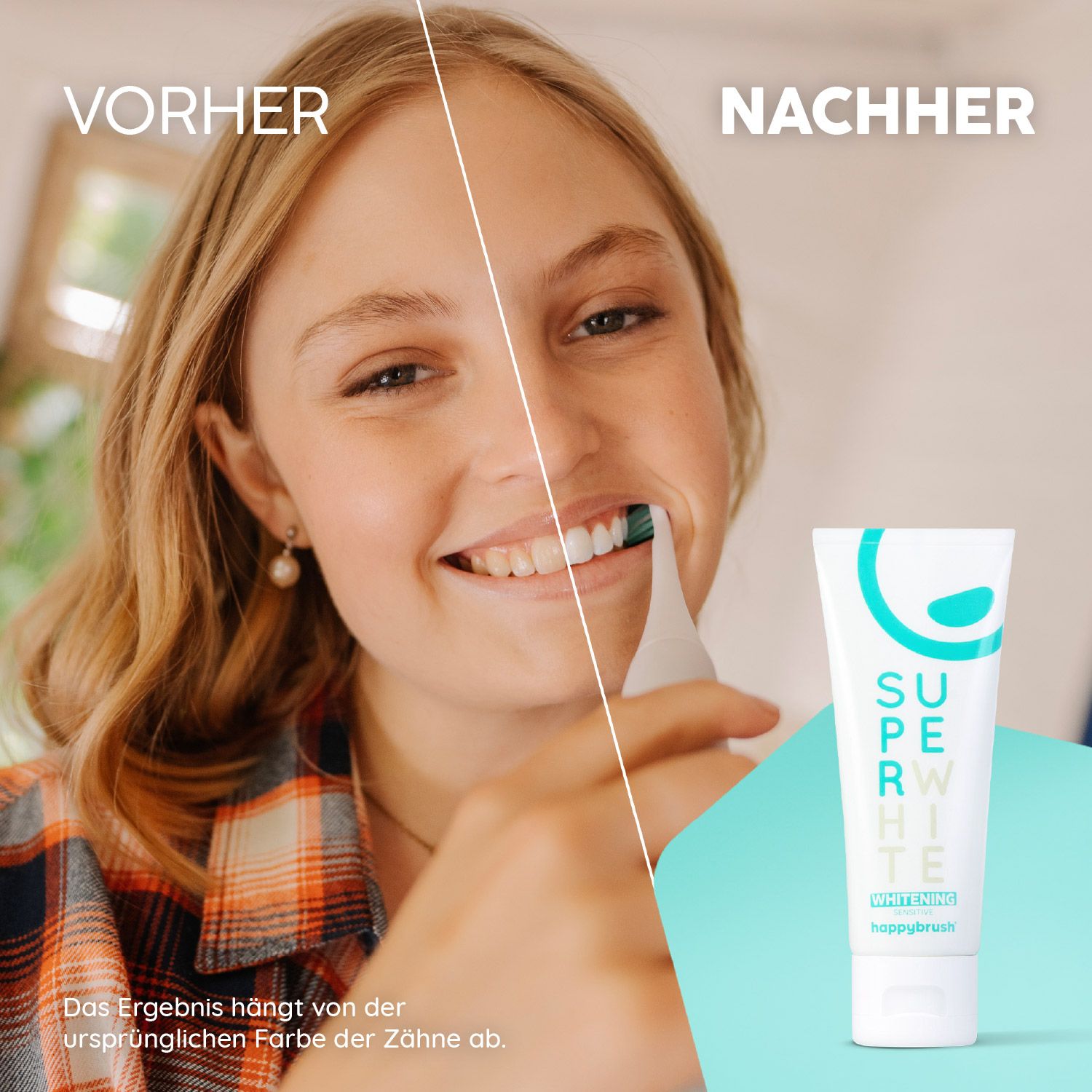 Vorher-Nachher-Vergleich. Frau putzt Zähne. Zahnpasta-Tube: Super White, happybrush. Ergebnis hängt von Zahnfarbe ab.