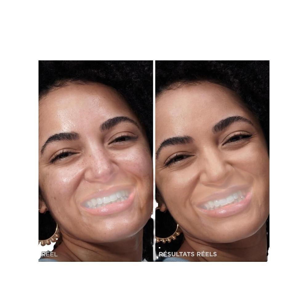 Zwei Fotos nebeneinander. Links: Gesicht mit Hautunreinheiten. Rechts: Gesicht mit ebenmäßigem Teint. Text: Résultats Reels.