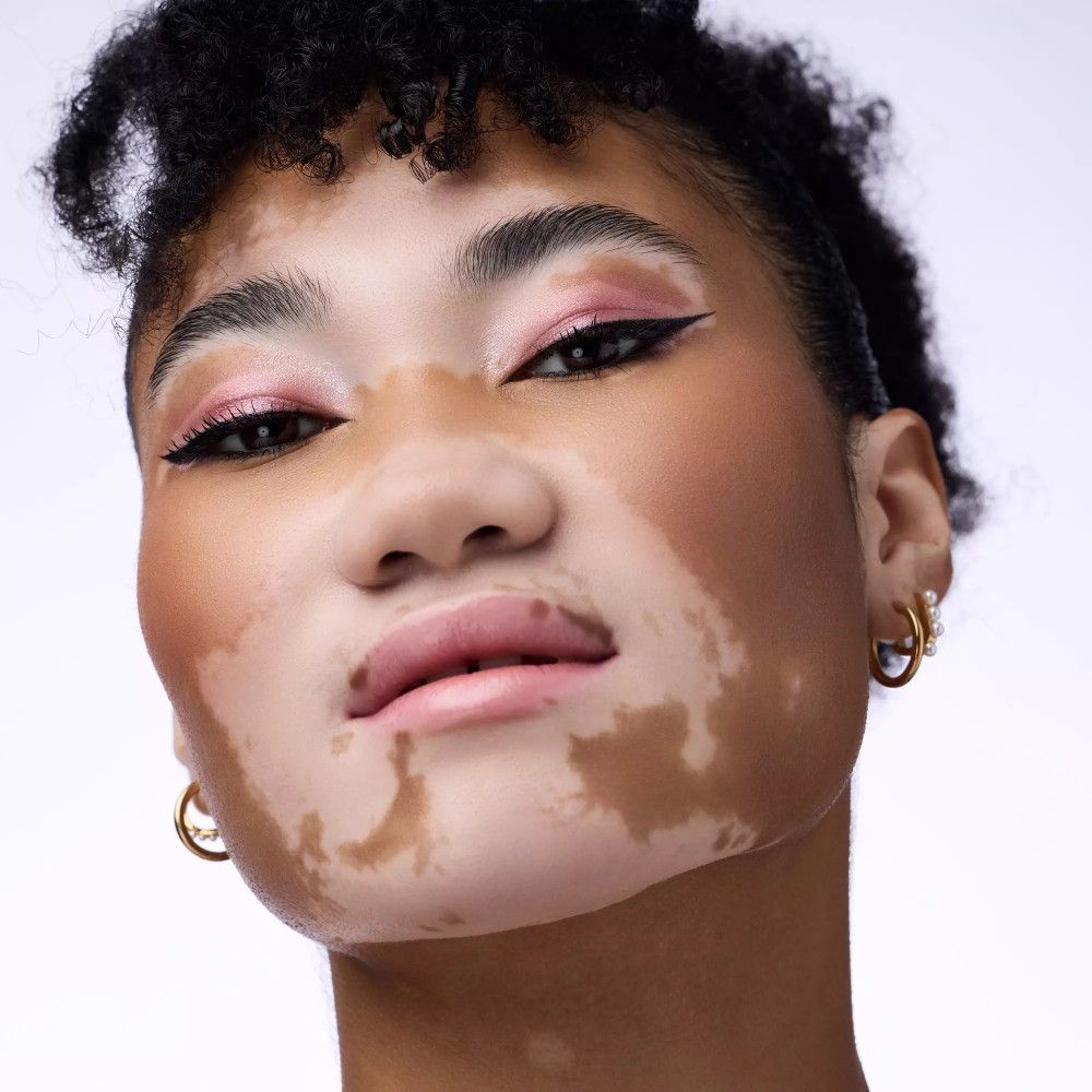 Porträt einer Person mit Hautunreinheiten und rosa Lidschatten. Schwarzer Eyeliner, goldene Ohrringe.
