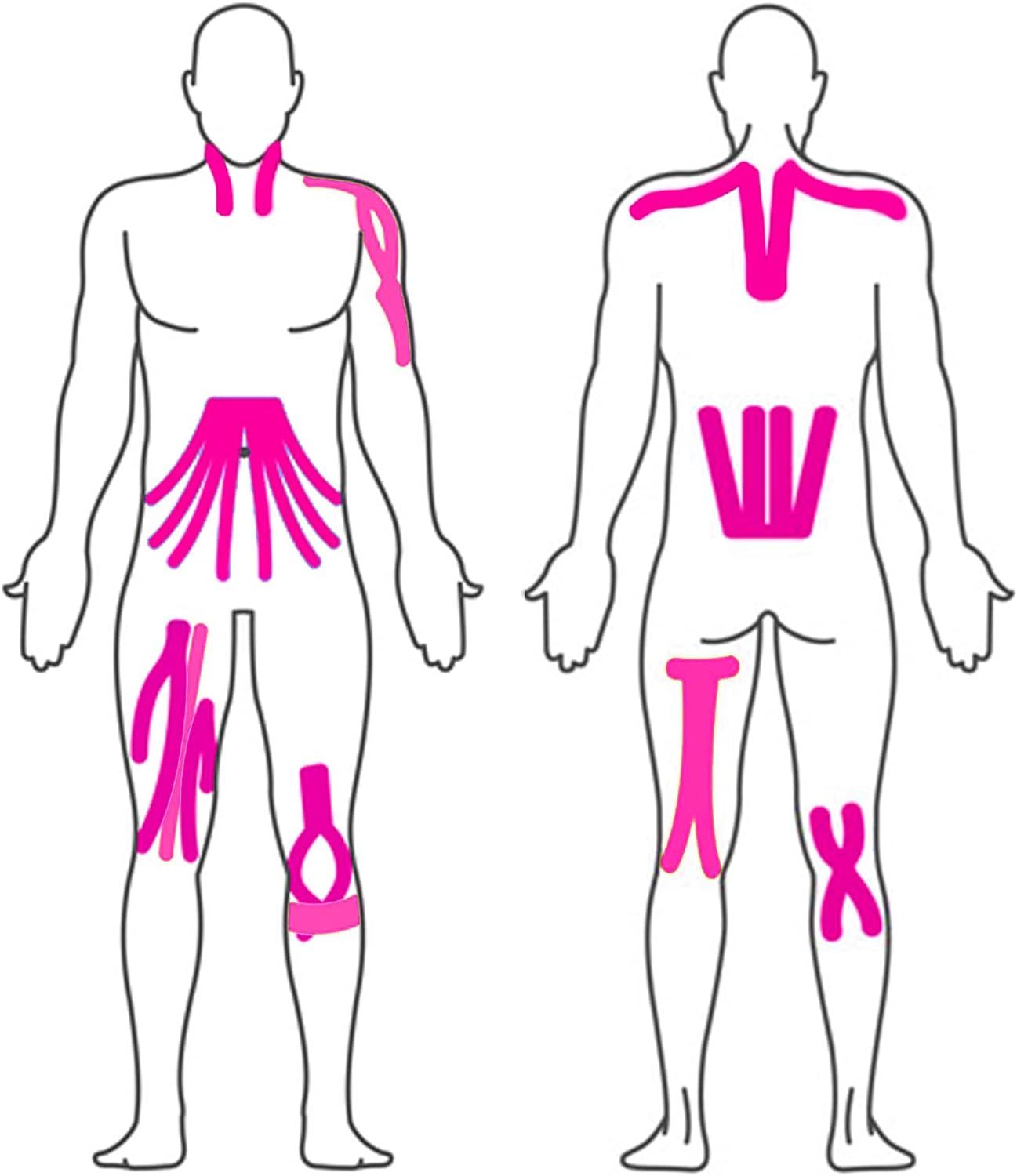 Zwei menschliche Silhouetten zeigen die Anwendung von rosa Kinesiologie-Tape. Die Tapes sind an verschiedenen Körperstellen angebracht, darunter Schultern, Rücken, Bauch, Beine und Knie.