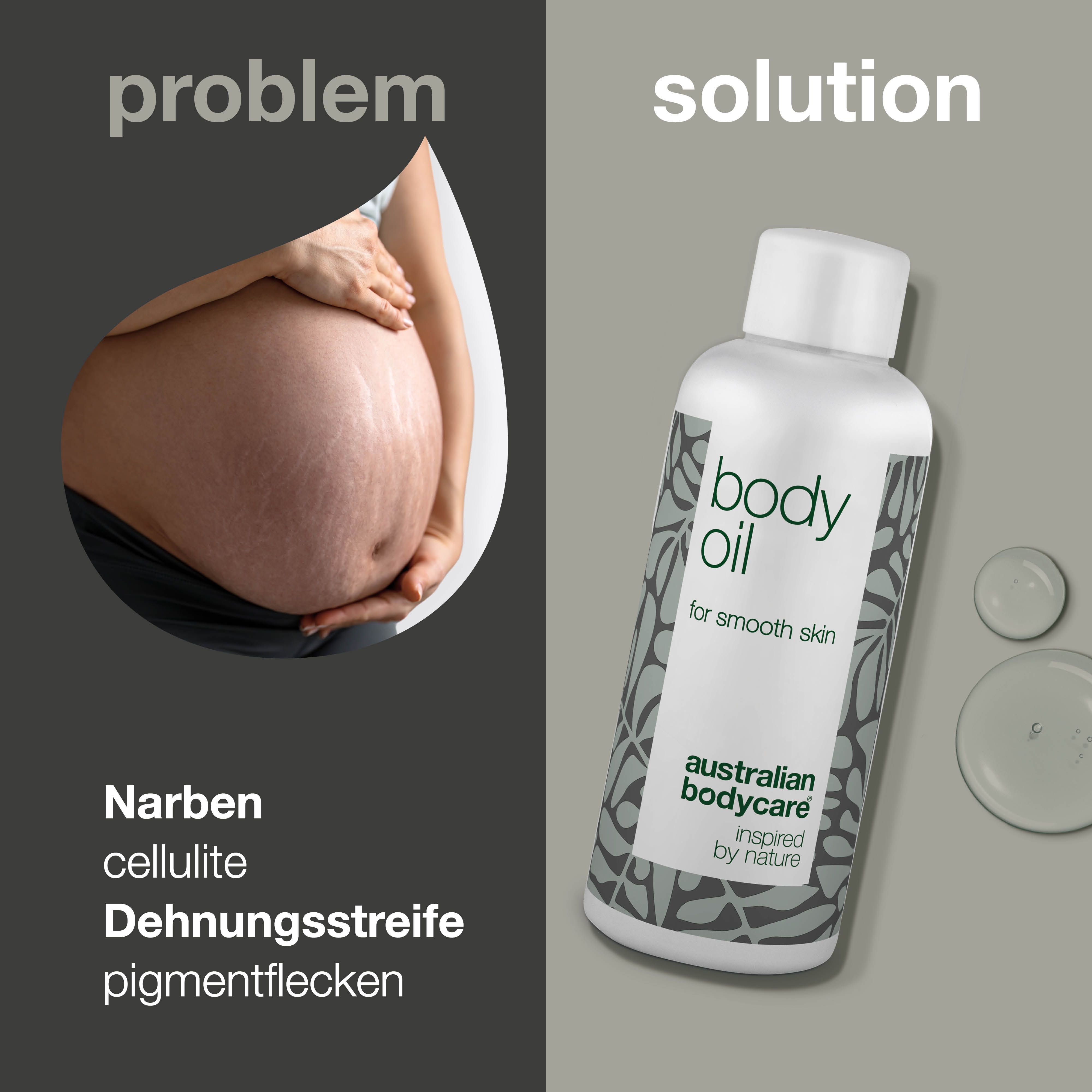 Schwangerer Bauch mit Dehnungsstreifen. Daneben Flasche mit „body oil“. Text: Narben, Cellulite, Dehnungsstreifen.