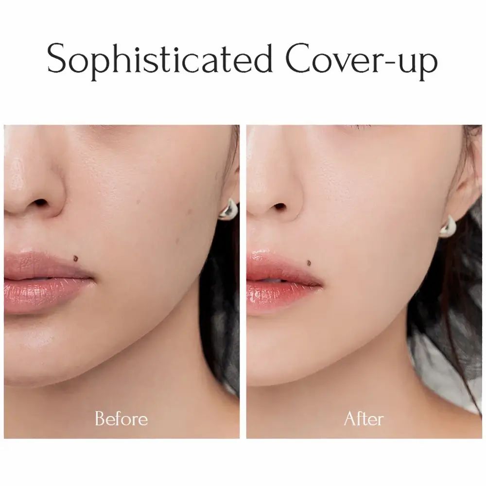 Vorher-Nachher-Vergleich von Haut. Auf der linken Seite Haut mit Unreinheiten, rechts ebenmäßiger.