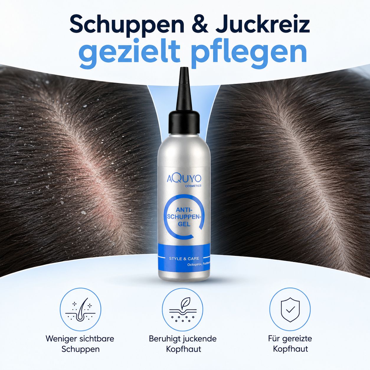 Flasche Anti-Schuppen-Gel zwischen Darstellungen von trockener und gesunder Kopfhaut. Icons zeigen weniger Schuppen, beruhigte Kopfhaut.