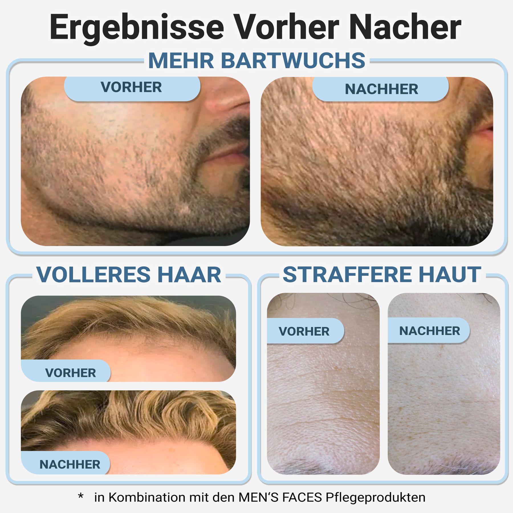 Vorher-Nachher-Vergleich: Bartwuchs, volleres Haar, straffere Haut. Ergebnisse in Kombination mit MEN'S FACES Pflegeprodukten.