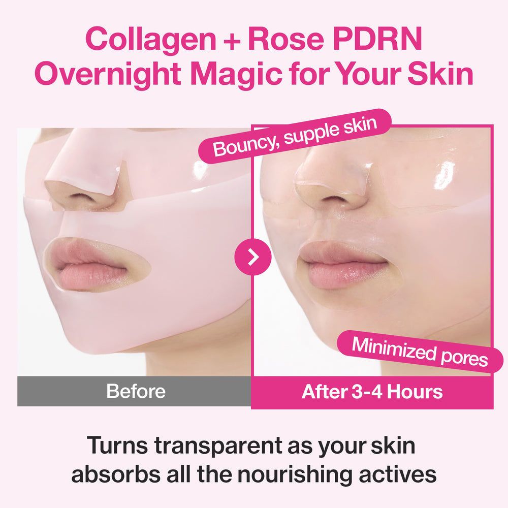 Vorher/Nachher-Vergleich der Haut mit NUMBUZIN Nr.2 Rose PDRN Overnight Collagen Hydrogel-Maske.