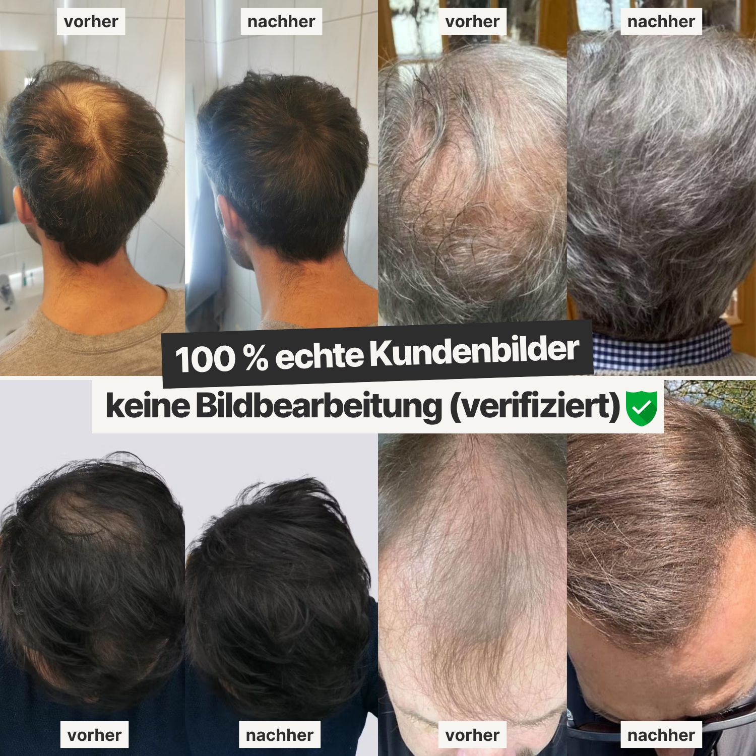 IMPERIO® Streuhaar zur Haarverdichtung - 100% Baumwolle, dermatologisch getestet