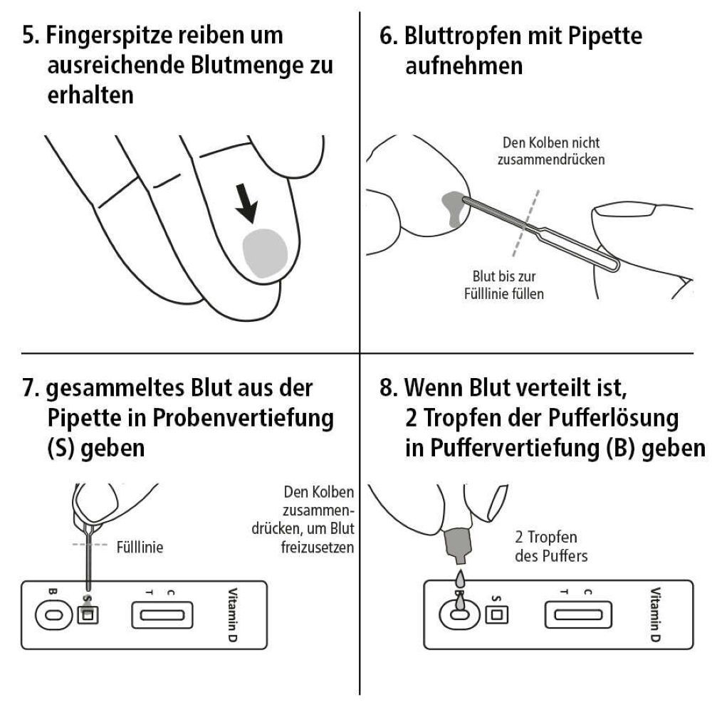 Fortsetzung der Testanleitung. Schritte 5-8: Finger reiben, Blut aufnehmen, Blut in Vertiefung geben, Pufferlösung hinzufügen.