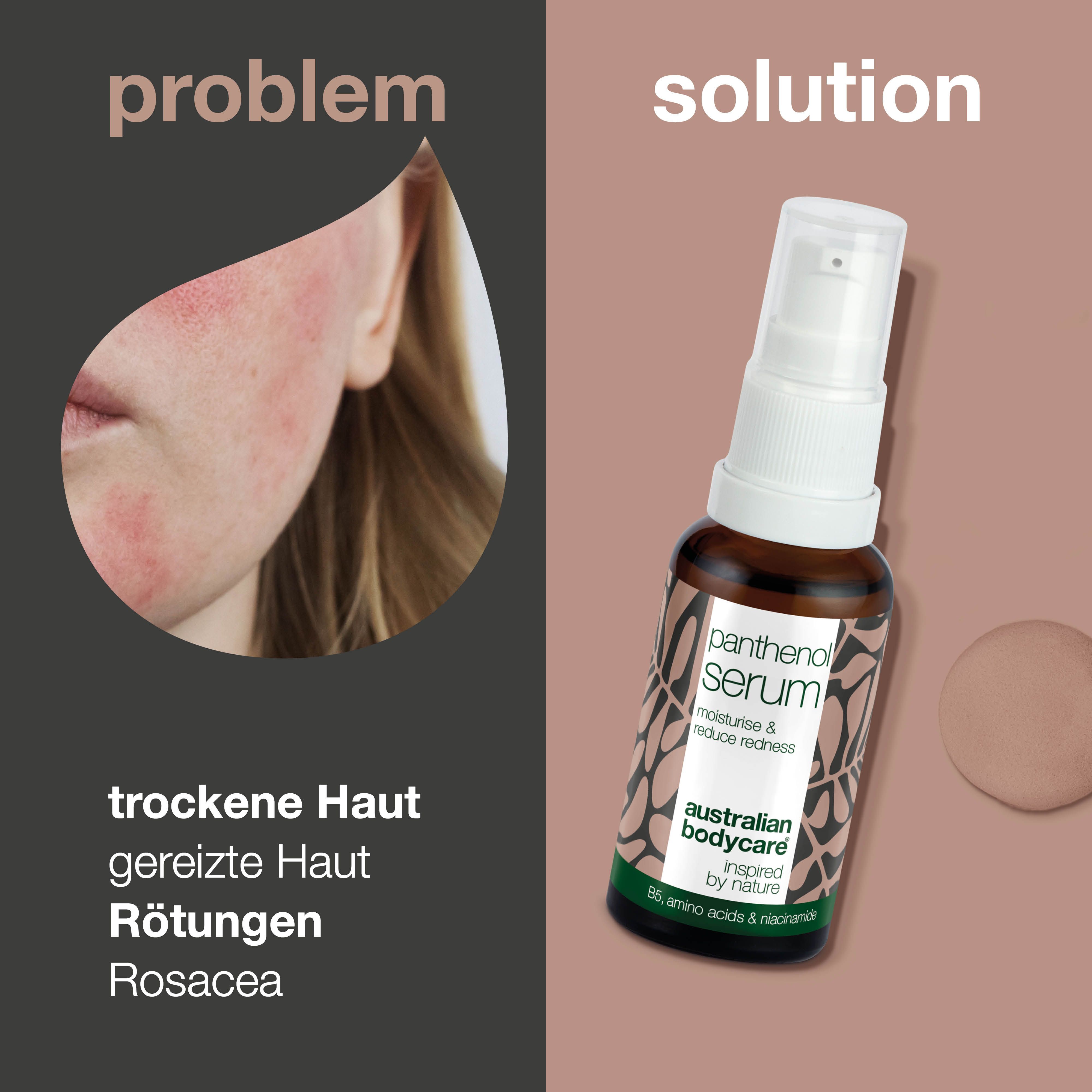 Gesicht mit Rötungen. Daneben Flasche Panthenol Serum. Text: trockene Haut, gereizte Haut, Rötungen.
