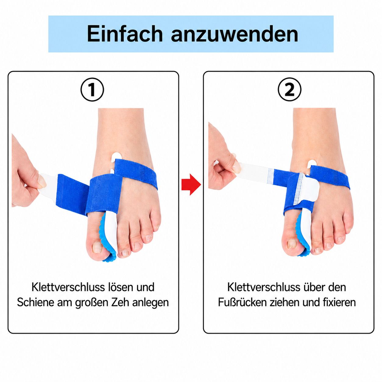 Einfache Anwendung der Hallux-Nachtbandage: Klettverschluss lösen, anlegen und fixieren am großen Zeh.