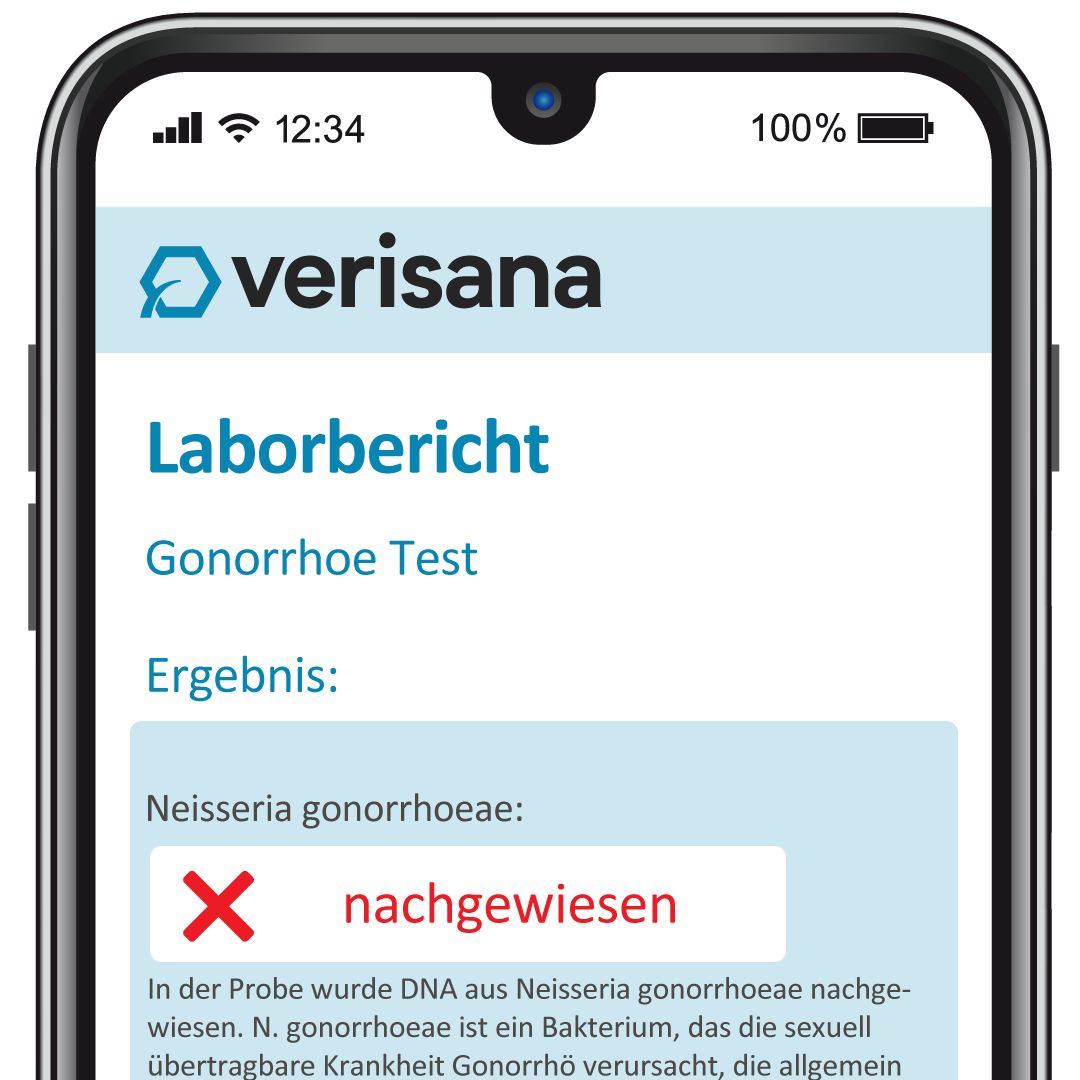 Verisana Gonorrhoe Test Mann 1 St