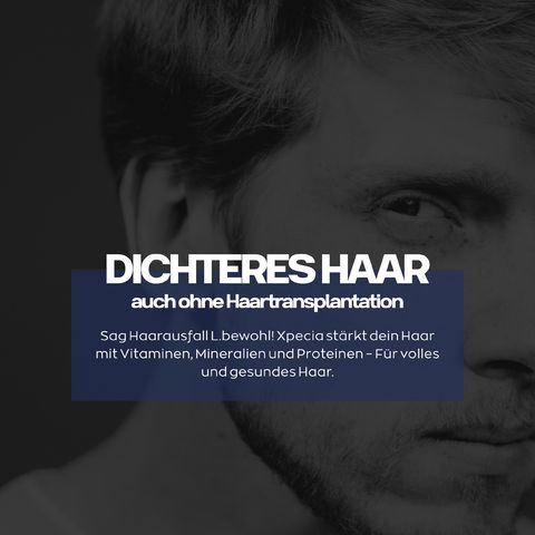 Mann mit Hand am Kopf. Text: Dichteres Haar auch ohne Haartransplantation. Vitamine, Mineralien, Proteine.