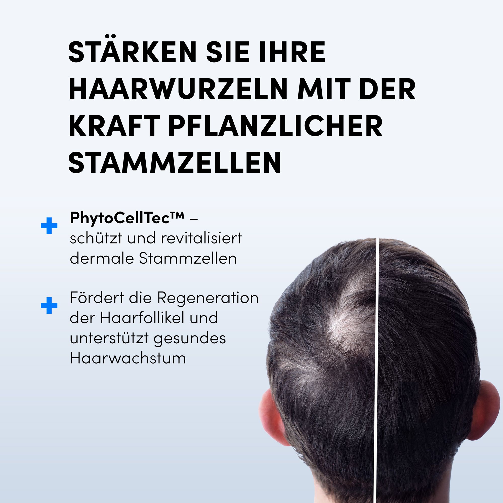 Rückansicht eines Mannes mit dünner werdendem Haar. Text: Stärken Sie Ihre Haarwurzeln mit der Kraft pflanzlicher Stammzellen.