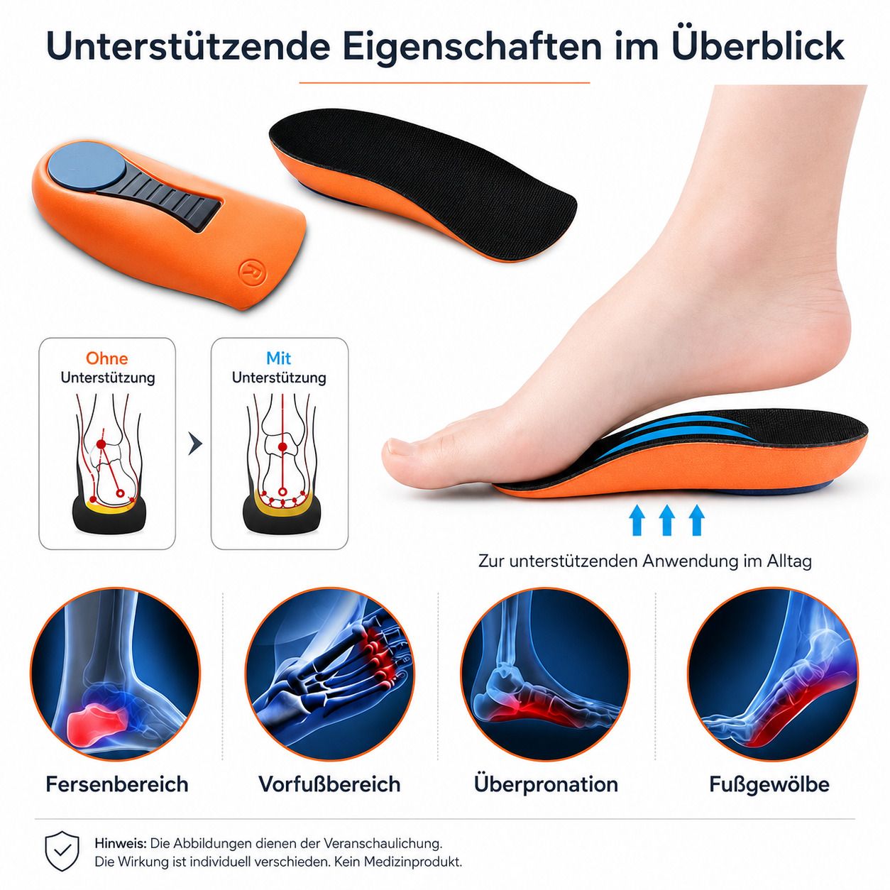 Vergleich von Fußstellung mit und ohne Unterstützung, Fokus auf Ferse, Vorfuß, Überpronation, Fußgewölbe.