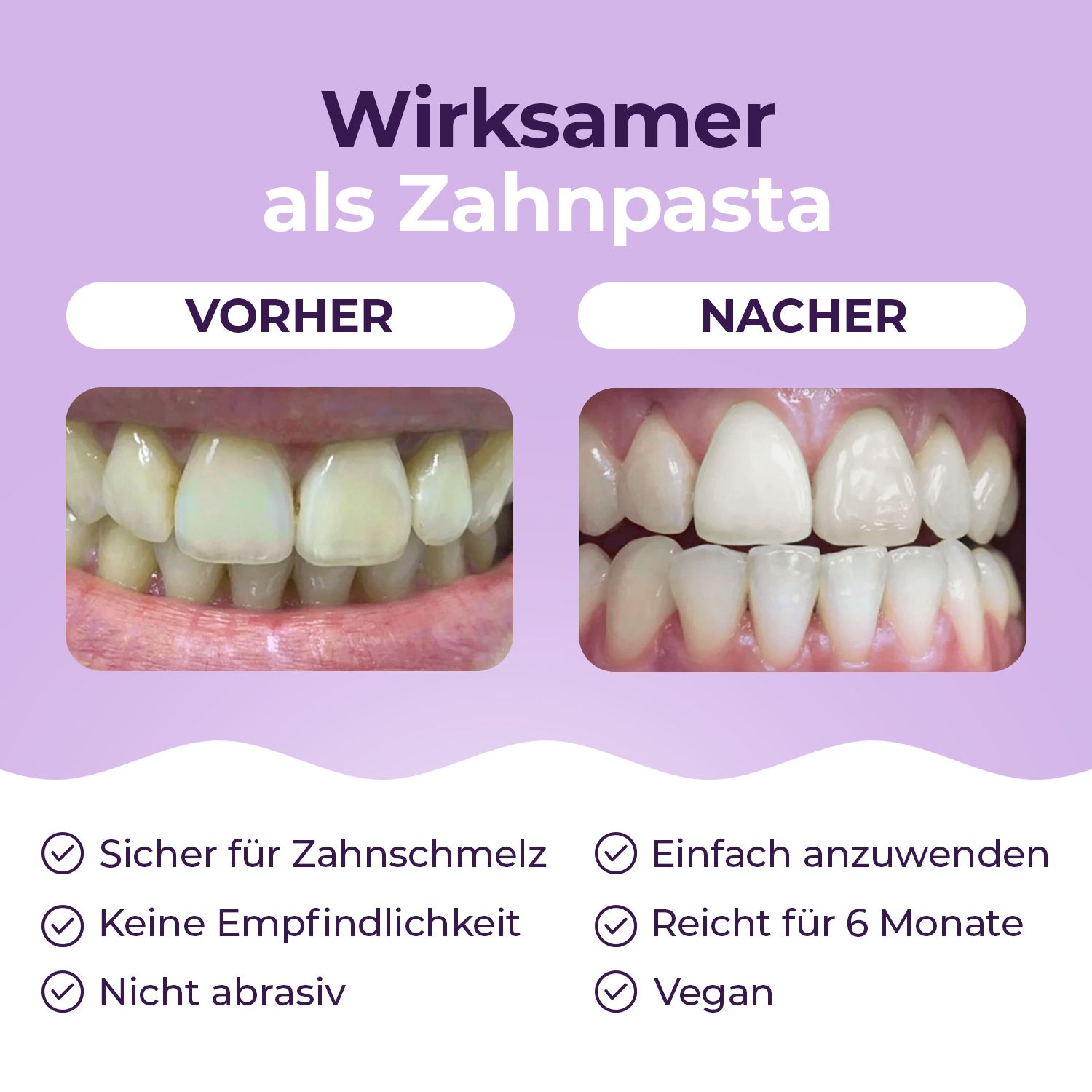Vorher-Nachher-Vergleich von Zähnen. Text: Sicher für Zahnschmelz, keine Empfindlichkeit, nicht abrasiv, vegan.