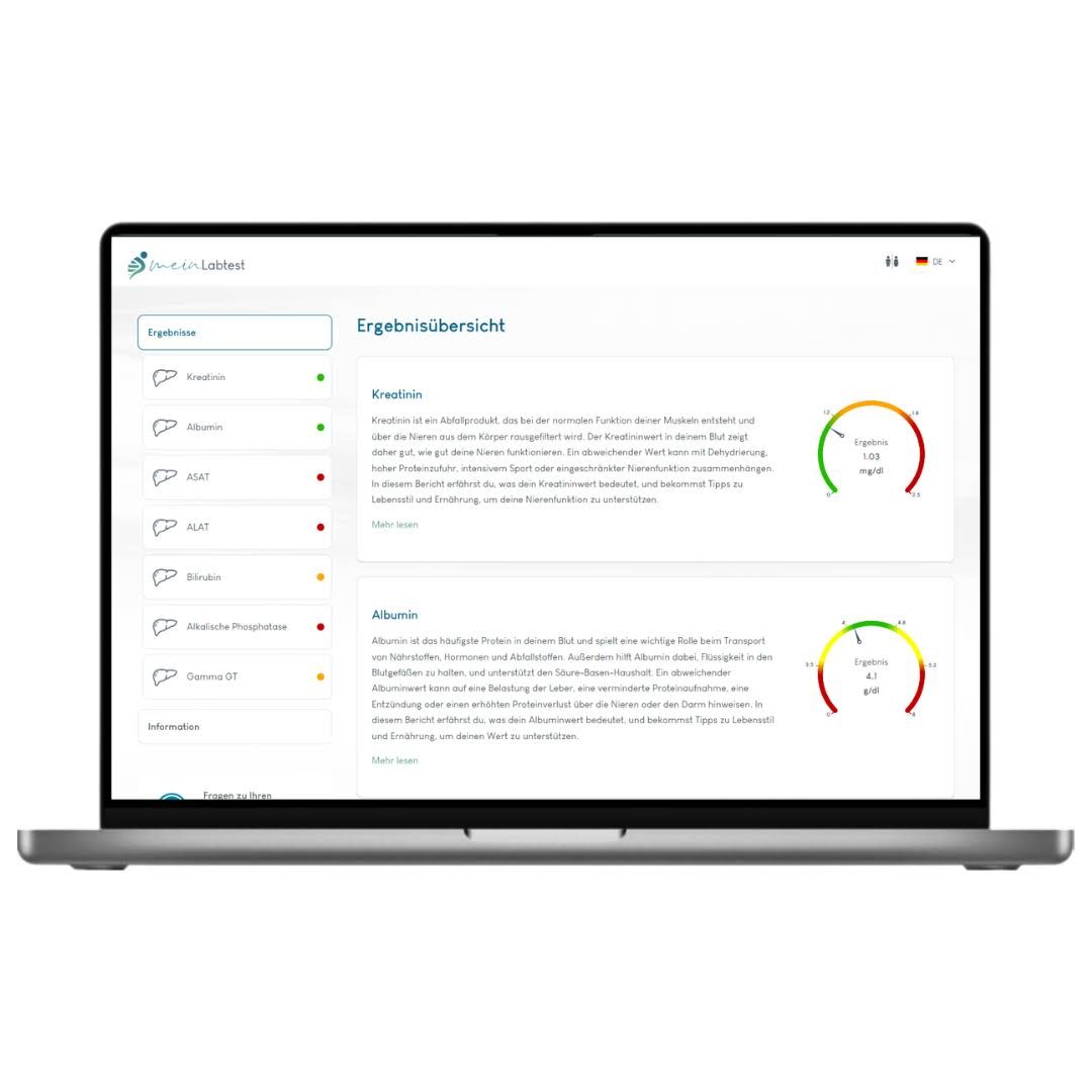 Laptop mit Meinlabtest-Ergebnissen. Ergebnisse mit farbigen Balken. Logo Meinlabtest.