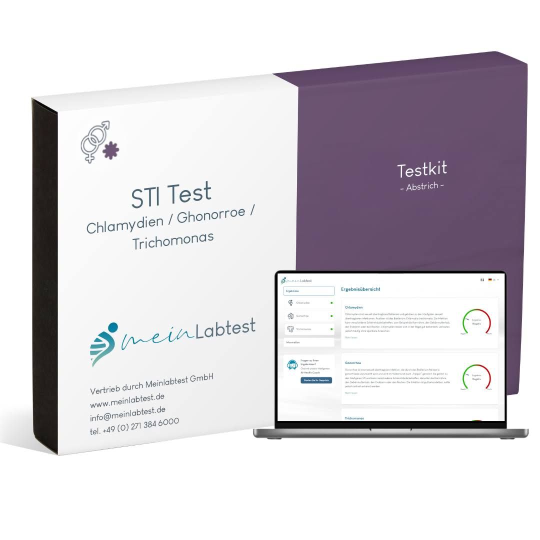 Box mit STI Test und Laptop. Meinlabtest Logo. Laptop zeigt Testergebnisse. Testkit-Abstrich. Weiß-lila Verpackung.