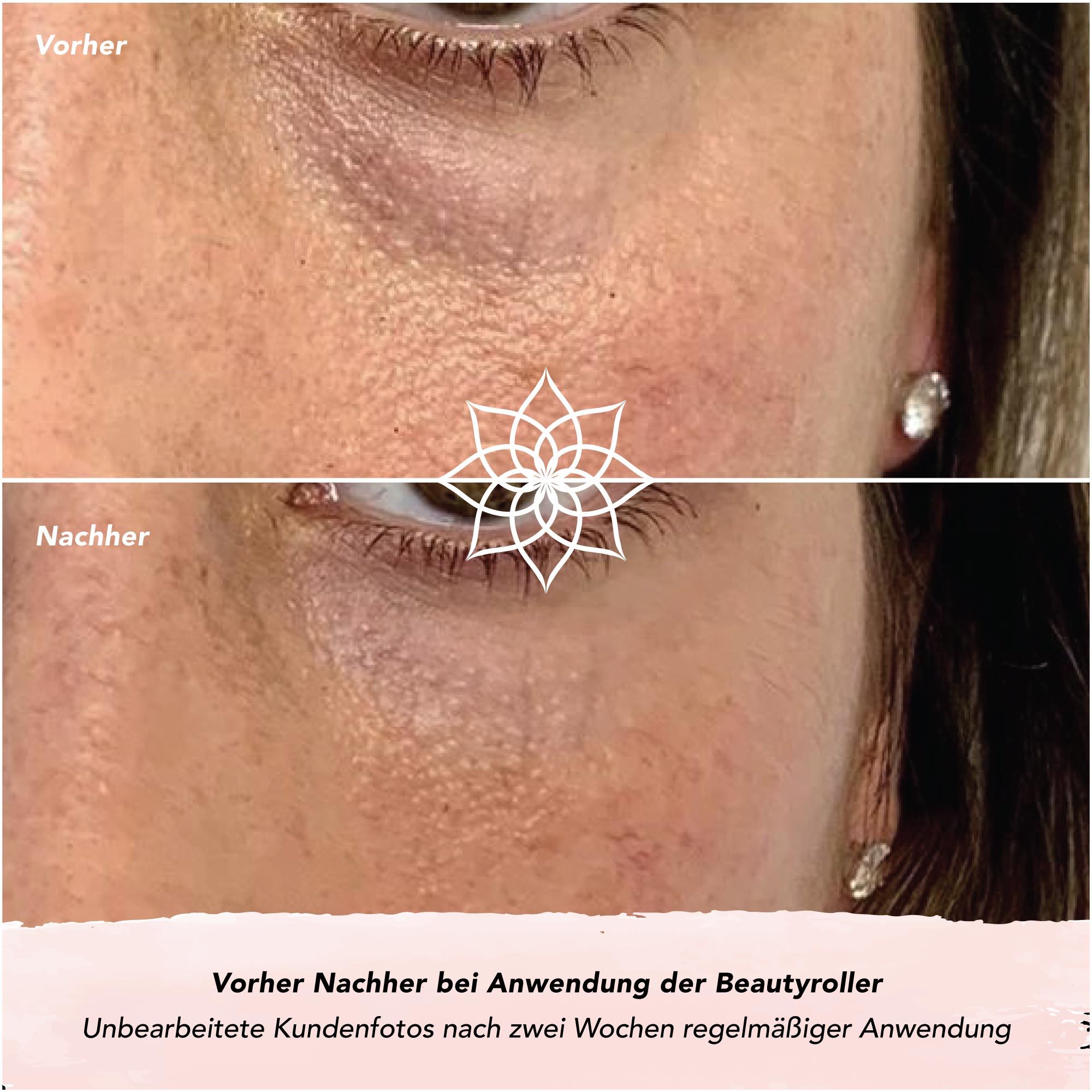 FACES OF FEY Rosenquarz-Roller