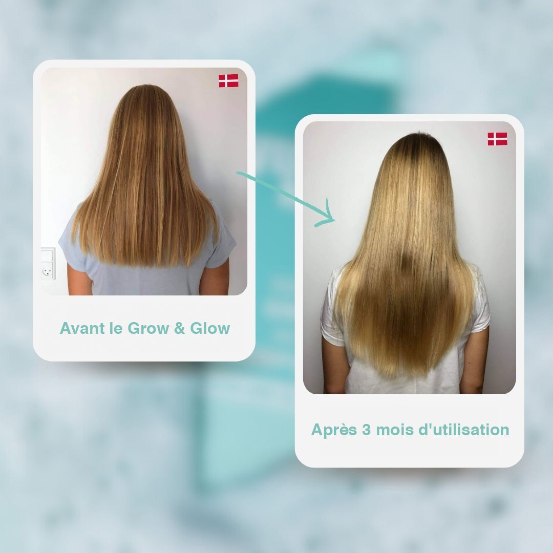 Comparaison avant-après. Cheveux blonds. Gauche : Avant les produits Grow & Glow. Droite : Après 3 mois d'utilisation. Flèche indiquant le changement.