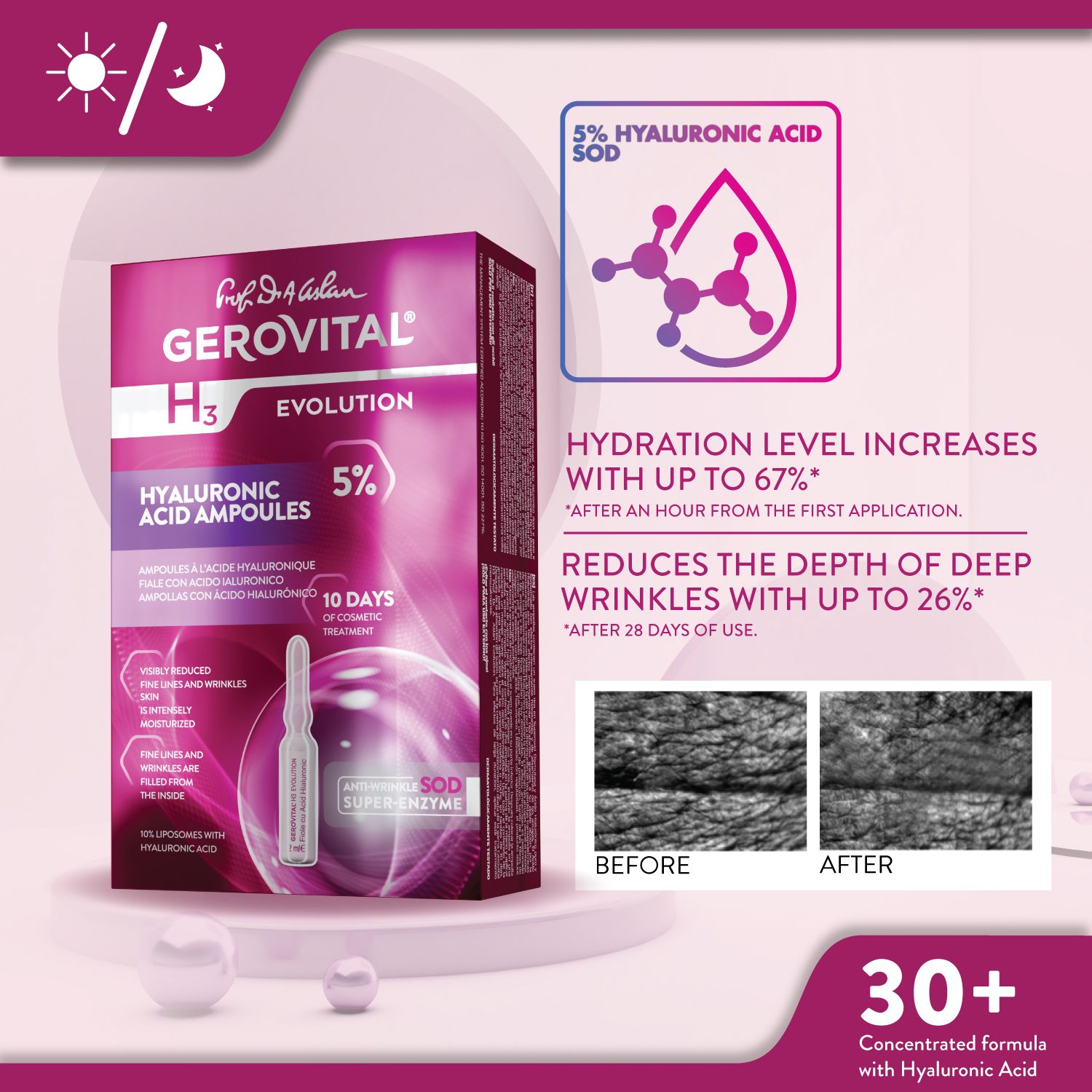 Gerovital-Packung mit Ampullen. Text: Hyaluronsäure Ampullen 5%. Hydratation steigt. Reduziert tiefe Falten. Vorher/Nachher-Bilder.