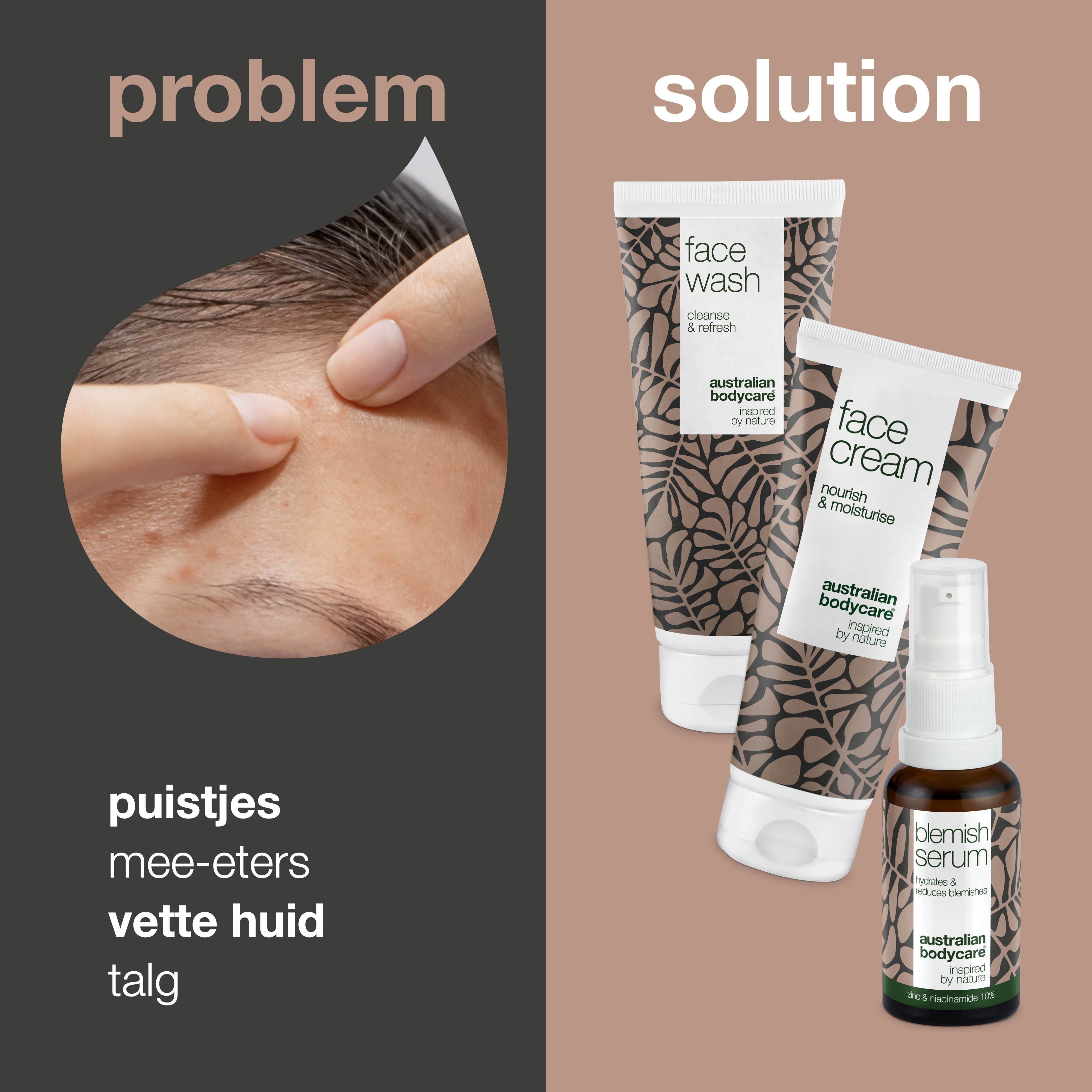 Grafiek met probleem en oplossing. Links: puistjes, mee-eters, vette huid. Rechts: producten.
