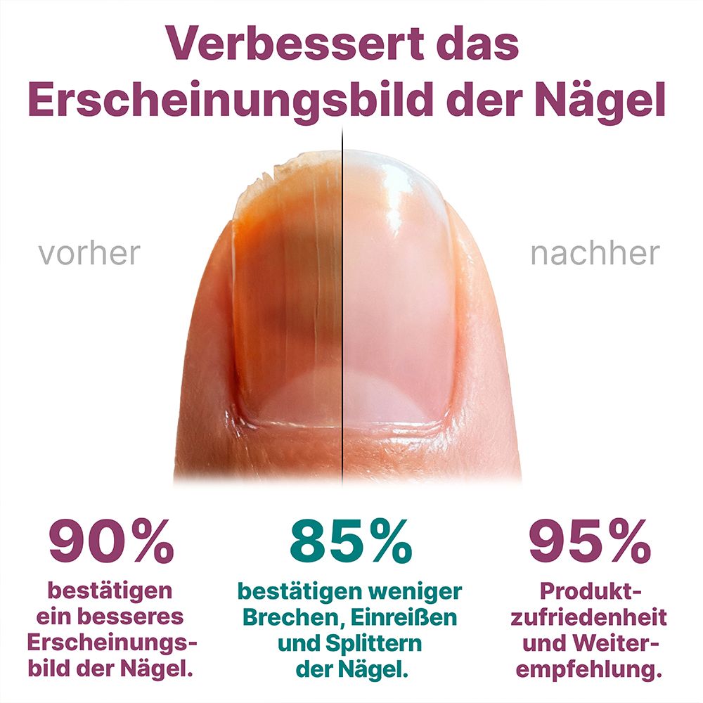 Nagelserum von CT