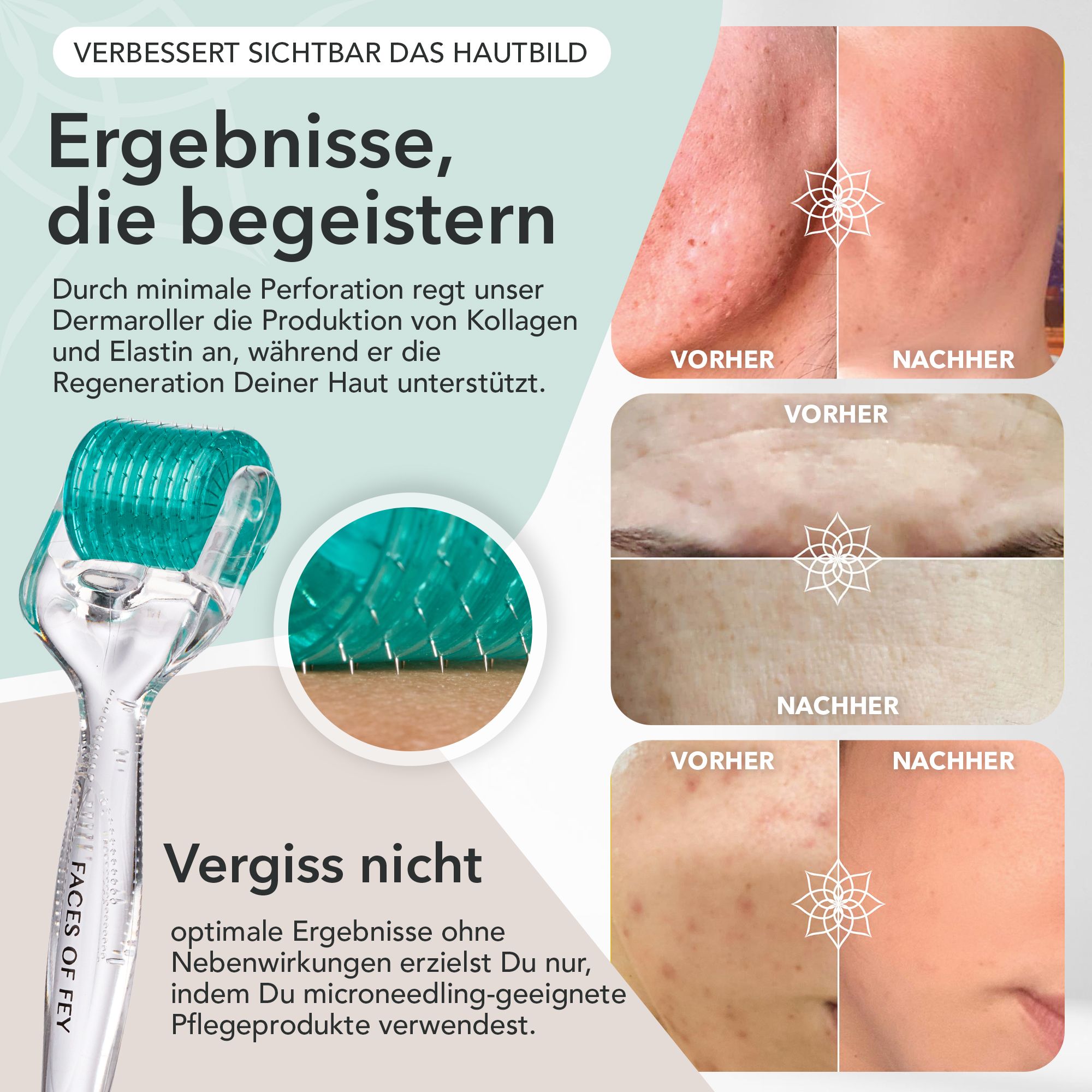 FACES OF FEY Dermaroller 0,5mm