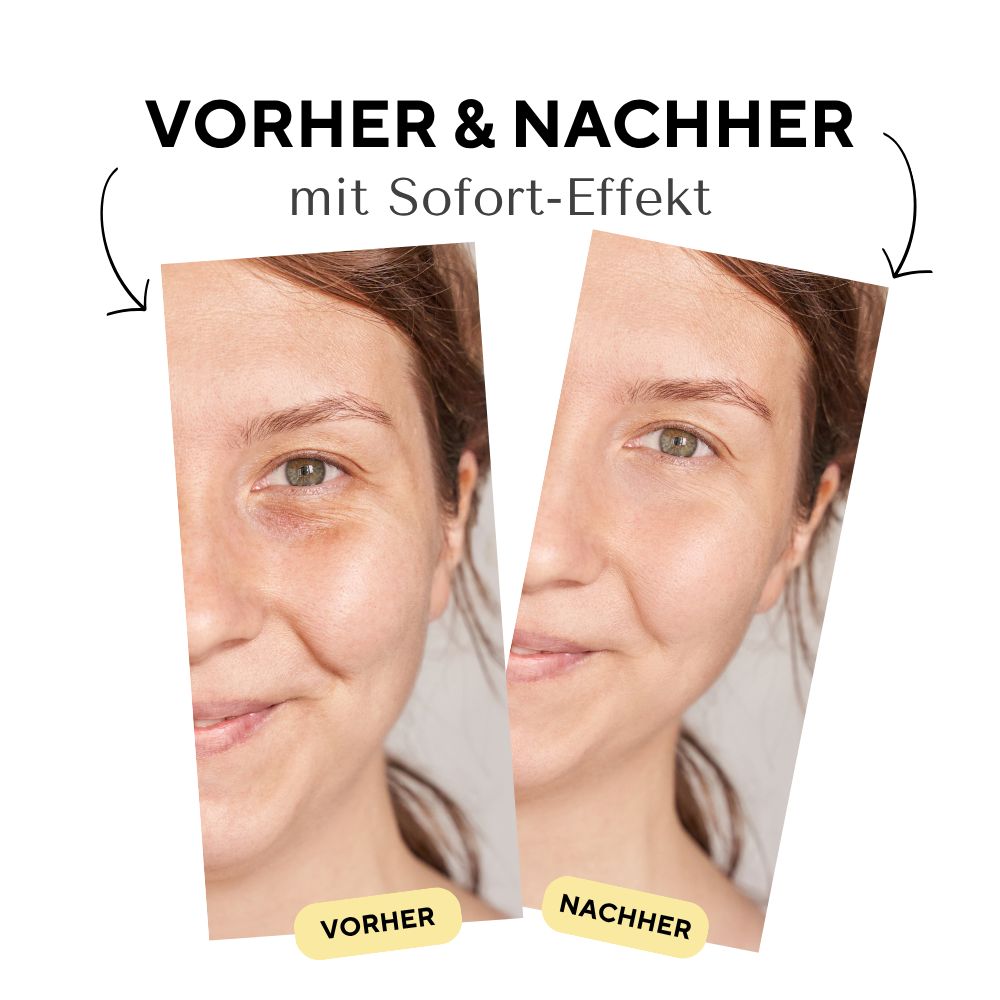 Vorher-Nachher-Vergleich. Zwei Gesichter. Links: Vorher, Augenringe. Rechts: Nachher, Haut verbessert. Text: mit Sofort-Effekt.