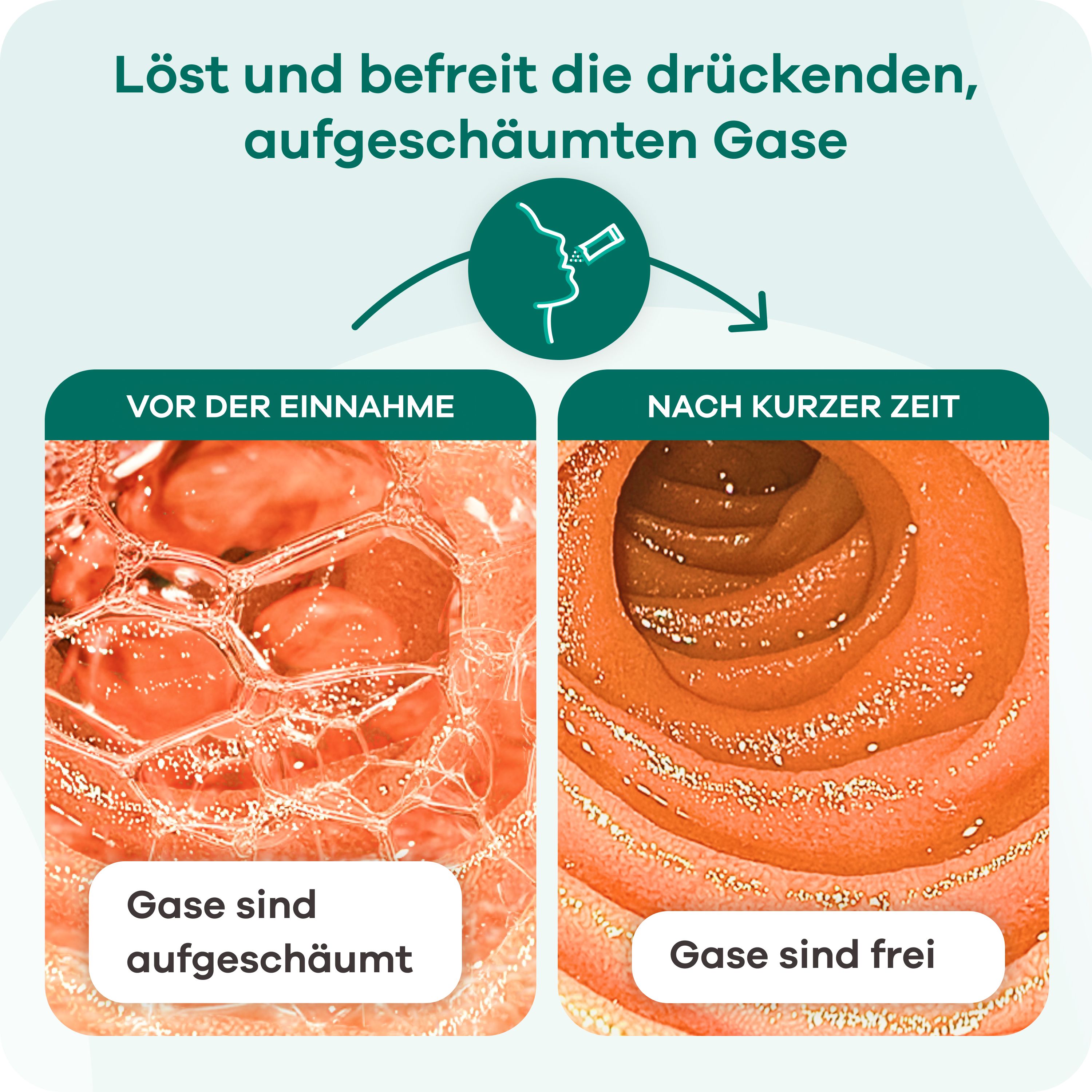 Vergleich von Darm vor und nach Einnahme. Text: Löst und befreit die drückenden, aufgeschäumten Gase. Gase sind aufgeschäumt, Gase sind frei.
