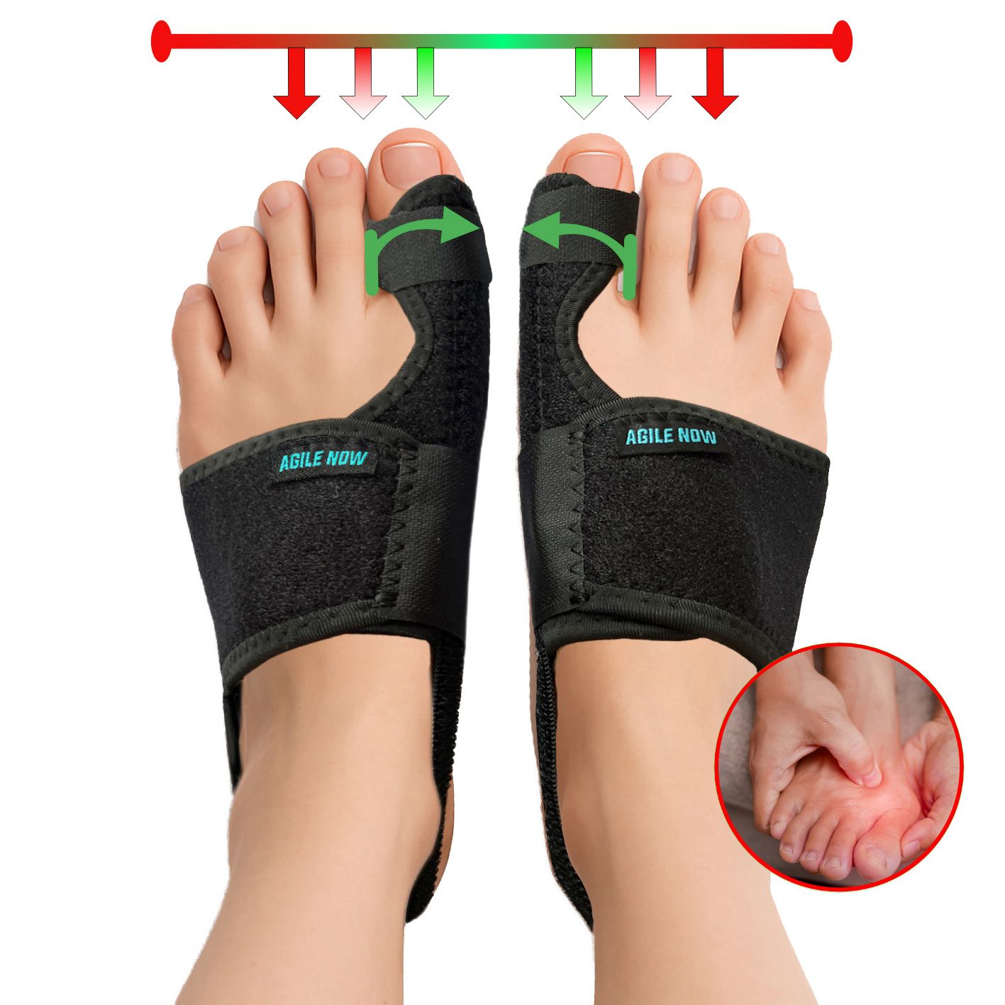 Zwei Füße mit AGILE NOW Hallux Valgus Bandagen. Pfeile und rote Markierungen zeigen die Korrektur an. Schwarze Bandagen mit Klettverschluss.