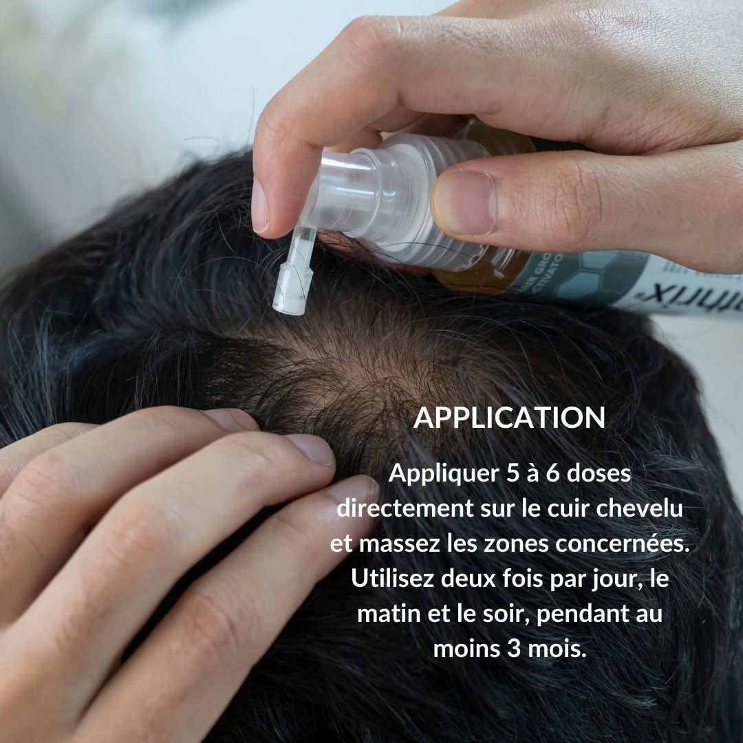 Mains appliquant le produit sur le cuir chevelu. Texte : Application. Appliquer 5 à 6 doses directement sur le cuir chevelu.
