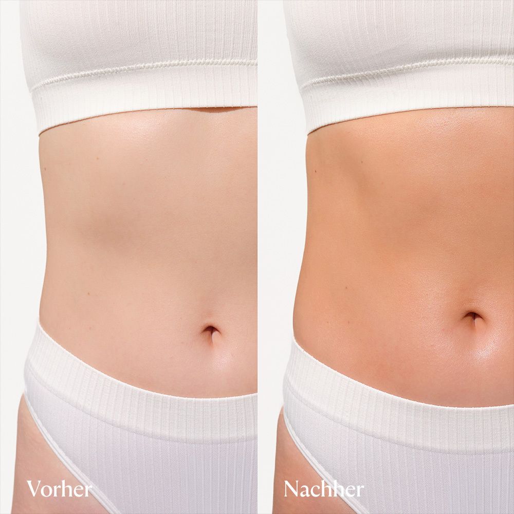 Vorher-Nachher-Vergleich der Bräunung am Bauch einer Frau.