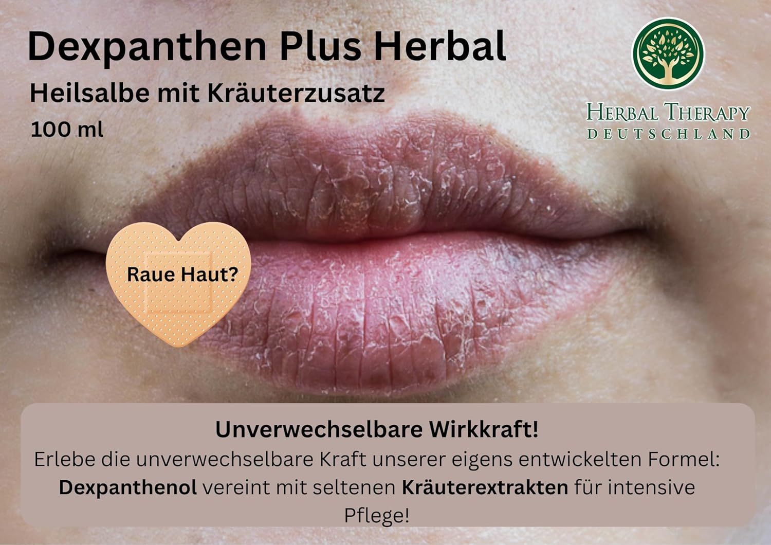 Dexpanthen Plus Herbal Salbe 100 ml auf Lippen mit trockener Haut. "Raue Haut?".