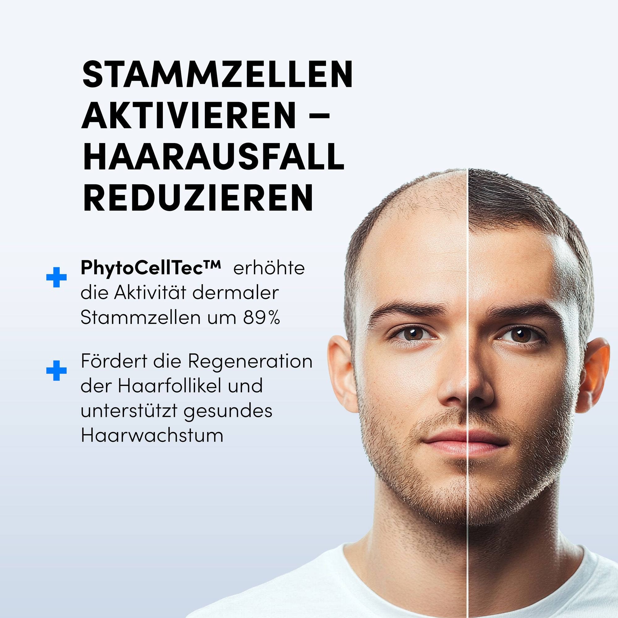 Mann mit geteiltem Gesicht. Eine Seite mit vollem Haar, die andere mit dünner werdendem Haar. Text: Stammzellen aktivieren - Haarausfall reduzieren.