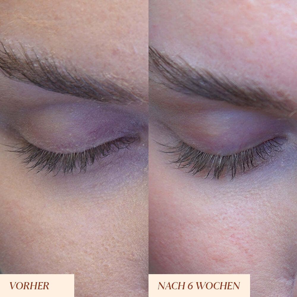 Augenpartie mit Wimpern. Vorher-Nachher-Vergleich. Text: Vorher, Nach 6 Wochen.