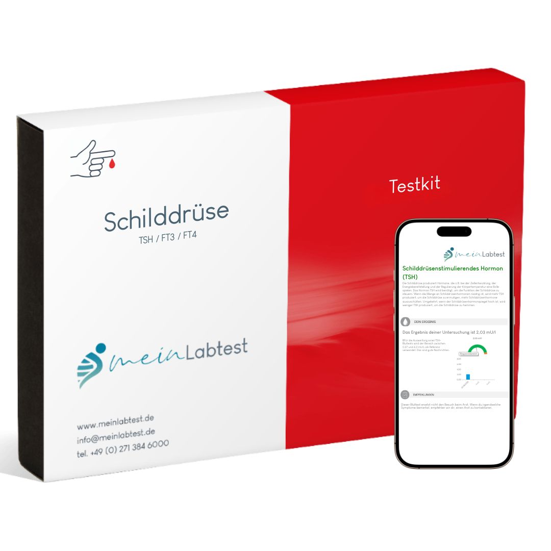 Testkit für Schilddrüsenuntersuchung. Enthält Testkit und Smartphone mit Testergebnissen. Logo: meinLabtest.