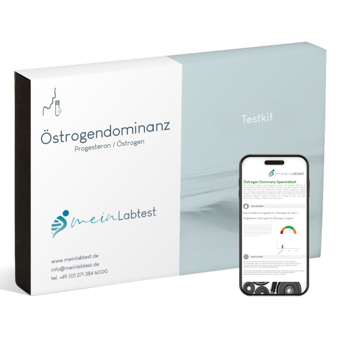 Testkit mit Aufdruck Östrogendominanz, Progesteron/Östrogen. Smartphone mit Testergebnis-Anzeige.