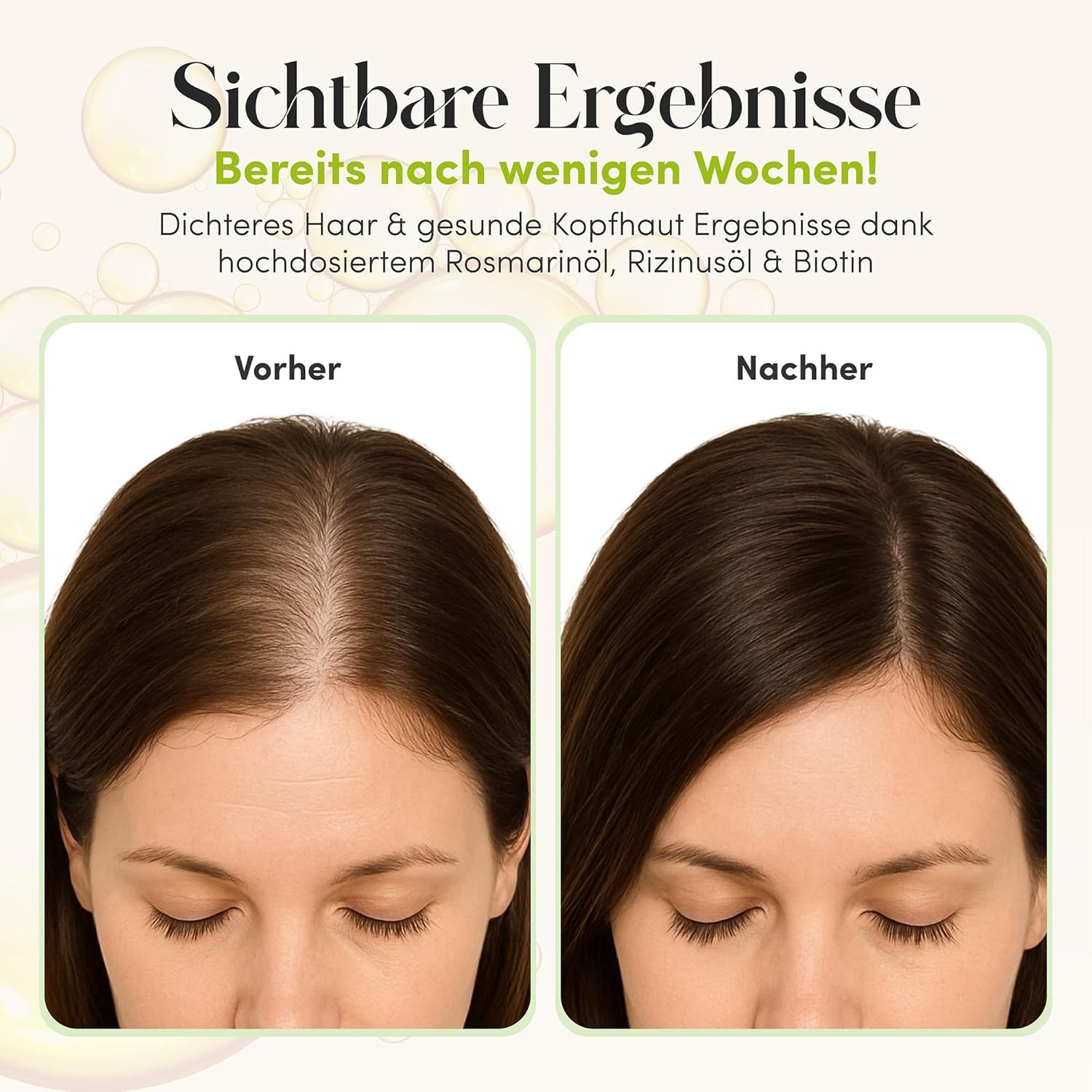 Vorher-Nachher-Vergleich. Text: Sichtbare Ergebnisse bereits nach wenigen Wochen. Dichteres Haar & gesunde Kopfhaut.