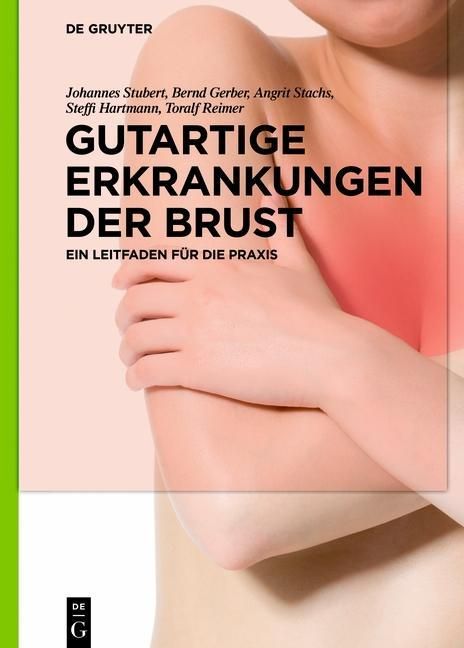 Gutartige Erkrankungen der Brust Ein Leitfaden für die Praxis